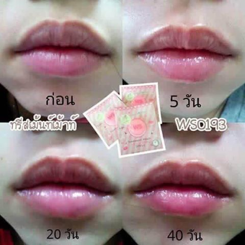 ปัญหาปากๆ จะหมดไป
